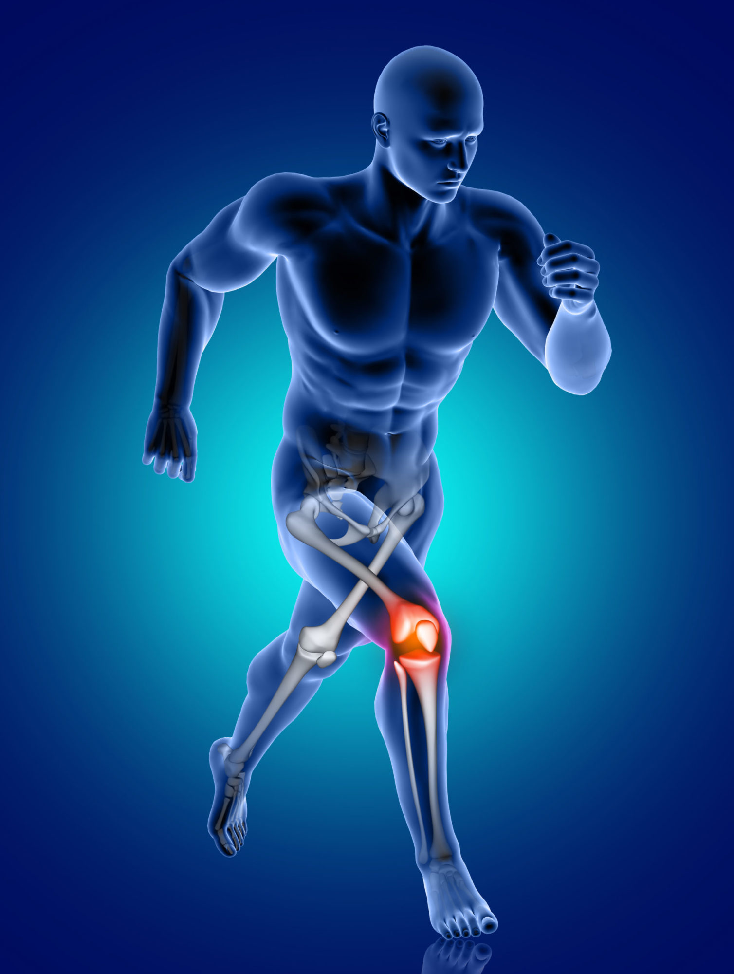 ACL Injury) Anterior Cruciate Ligament Tear Symptoms & Surgery